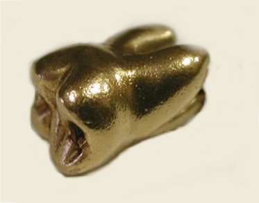 Bocas de ouro